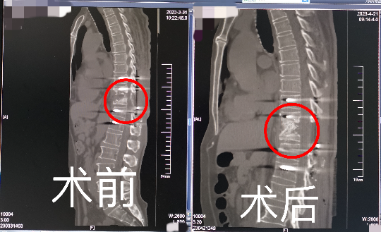 已编辑图片