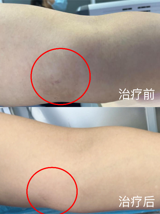 已编辑图片